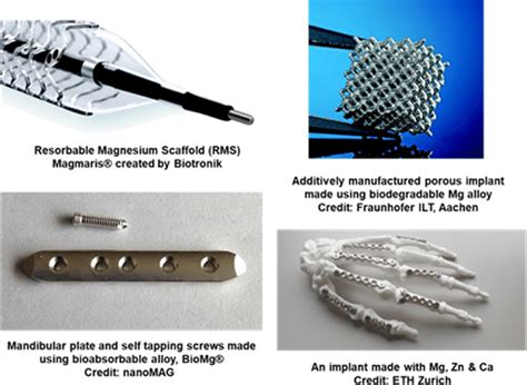  Magnesiumbaserade legeringar - Framtidens hållbara material för lättviktskonstruktioner!